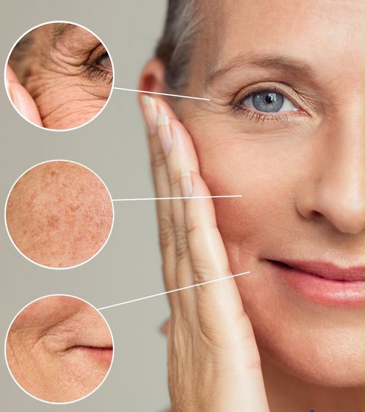 Dermato Estética
